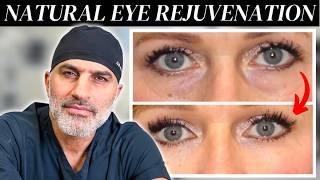 How to Surgically Rejuvenate Your Eyes Naturally (Without Looking fake)