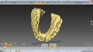 Importing STL Model Data to inLab SW #66