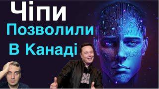 Ілону Маску Канада дала зелене світло на імплантацію чіпів людям в мозок…