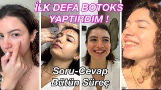 İLK DEFA BOTOKS YAPTIRDIM 🫠 Acıdı Mı ? Ne Kadar Sürede Oturdu? | Bütün Süreç | Soru-Cevap