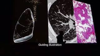 AIRP Thoracic and Cardiovascular Imaging Course: A Look Into Rad-Path Correlation