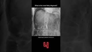 Abdominal X-ray Question 1