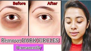 Remove Dark Circles Permanently In A Week #shorts #youtubeshorts | Devanshi kalra