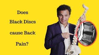 Does Black disc cause Back pain?