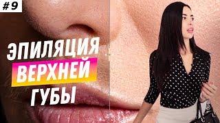 ЛАЗЕРНАЯ ЭПИЛЯЦИЯ ВЕРХНЕЙ ГУБЫ | ДО И ПОСЛЕ | Что лучше ЭПИЛЯЦИЯ ЛАЗЕРОМ, ВОСКОМ ИЛИ ЭПИЛЯТОРОМ