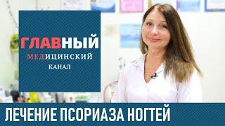 Псориаз ногтей: симптомы и лечение. Как и чем лечить псориаз на ногтях