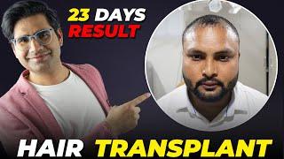 Transform Your Look with a Hair Transplant Success Story | Awish Clinic | Hair Transplant | #viral #