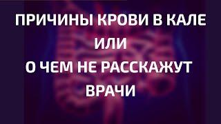 Кровь в кале: причины. Паразитология. Выпуск 65. Лекция Ирины Витальевны Стефановской.