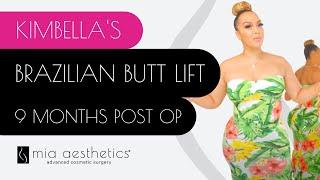 Kimbella's BBL - 9 Month Post Op - Brazilian Butt Lift Before & After By Dr. Mehio At Mia Aesthetics