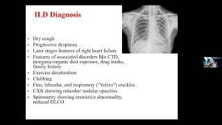 RMPP 01- Session 04- ILD and Post covid fibrosis- Dr Unnati Desai