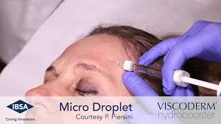 Viscoderm Hydrobooster - Microdroplet  Technique Forehead Area