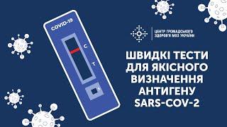 Швидкі тести для якісного визначення антигену SARS-COV-2