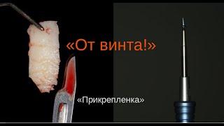 "От винта!!!" Прикреплёнка.