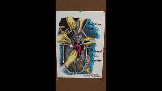 The Bookwalter Retractor—A Resident’s Best Friend