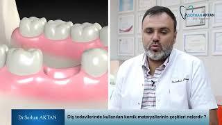 Diş Tedavilerinde Kullanılan Kemik Materyallerin Çeşitleri Nelerdir? - Dr. Serhan Aktan