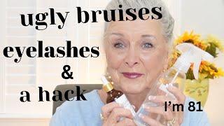 Ugly Bruises|Eyelashes & Hack~Get Ready With me !