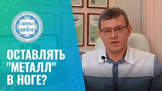  Перелом зажил - нужно ли удалять металлоконструкцию