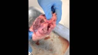 Cleopatra Giffard - heart dissection for Jenny Hill