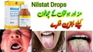 Nilstat Oral Drops | Nystatin | Fungal Infection | Candidiasis | Oral infection in Childrens