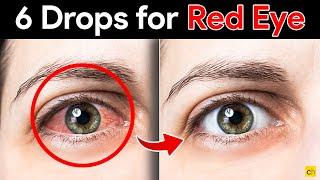 Fast and Effective: 6 Eye Drops to Cure Red Eyes - Credihealth