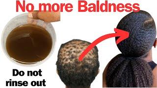 The Most Potent DIY Hair Growth Tea You Need To Try For Guaranteed Baldness Reversal. Try It Now!