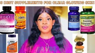 BEST SUPPLEMENTS FOR GLOWING SKIN: Dietary Supplement - Pill : Best Vitamins / Collagen Supplements