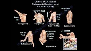 Clinical Examination Of Shoulder & Rotator Cuff - Everything You Need To Know - Dr. Nabil Ebraheim