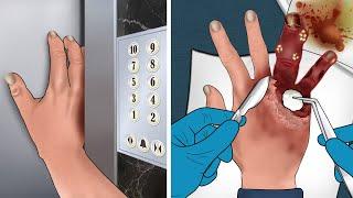 [ASMR Animation] Treatment of hand injuries caused by stuck elevator doors