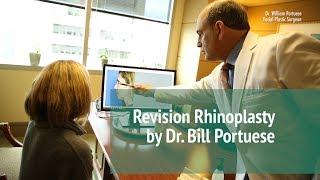 Revision Rhinoplasty Surgery | Seattle Facial Plastic Surgeon - Dr. William Portuese  ‍️