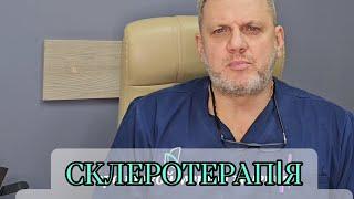 Склеротерапія -що це та для чого? Лікування варикозу