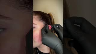 Hidden helix piercing by @undergroundbodypiercing 