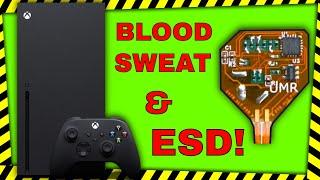 Xbox Series X Blood Sweat & Frustration!!