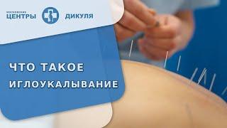  Что такое иглоукалывание, какие к нему показания и противопоказания? Что такое иглоукалывание. 18+