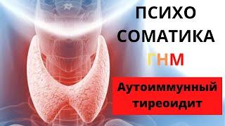 Психосоматика аутоиммунного тиреоидита. Щитовидная железа и её конфликт со слов носителя диагноза