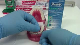 How to Clean the Teeth with Braces