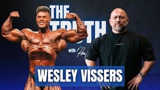 WESLEY VISSERS 6 WEEKS OUT ARNOLD CLASSIC EP. 122