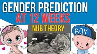 Early Gender Prediction in scan using NUB theory 12 weeks Pregnancy