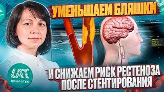 Уменьшаем бляшки и снижаем риск рестеноза после стентирования с безболевой ишемией.