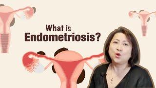 What is Endometriosis?