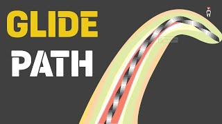 Glide path in Endodontics