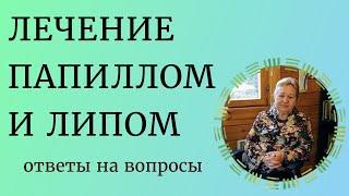 ЛИПОМЫ И ПАПИЛЛОМЫ: как лечить? Советы фитотерапевта. Лекция Ирины Стефановской. Выпуск 80.