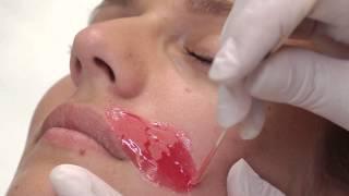 Face depilation with HOT FILM WAX "Italwax"