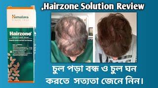 Hairzone Solution Review | Himalaya Hairzone Solution Use And Benefits | চুল পড়া বন্ধ ও ঘন করতে