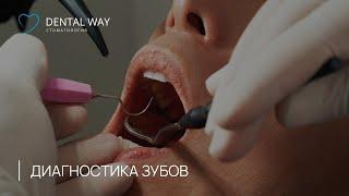 Диагностика зубов в стоматологической клинике Dental Way