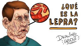 LEPRA | Draw My Life