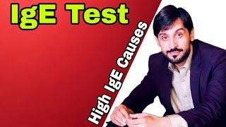 IgE Test | IgE Test Kya Hota Hai | IgE Level | MLT Hub with kamran