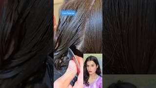 How to get rid of lice from hair permanently ️#licecomb #lice#shortsviral #hairhacks #explore
