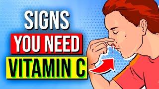 9 Alarming Signs Your Body NEEDS More Vitamin C!