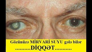 DİQQƏT! Gözünüzə Mirvari Suyu gələ bilər - Kataraktanın MÜALİCƏSİ