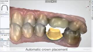 3D BioCAD - 3Shape Dental System Single Crown